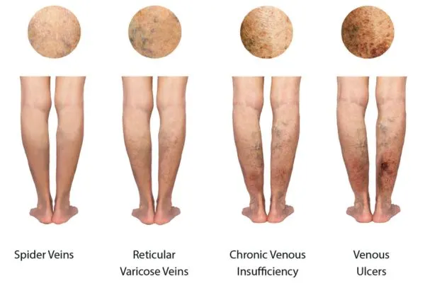 nzljvqsvknm5t77yaf1d