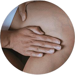 Why do varicose veins form