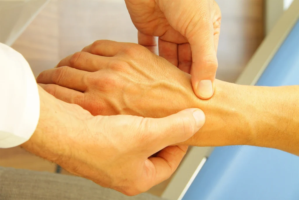 Microphlebectomy large hand vein